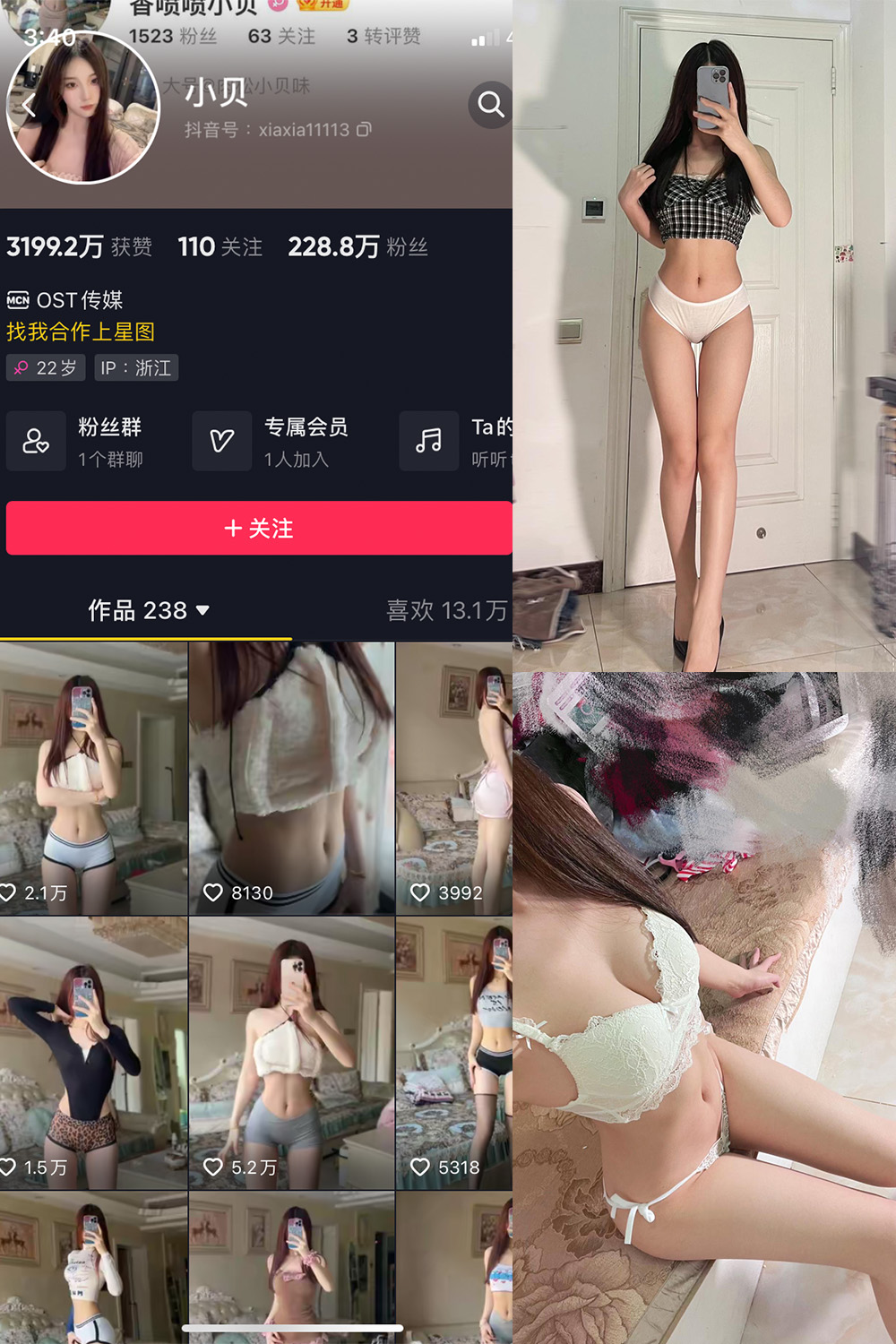 抖音 小贝 VIP 微密圈 NO.012期 【25P4V】